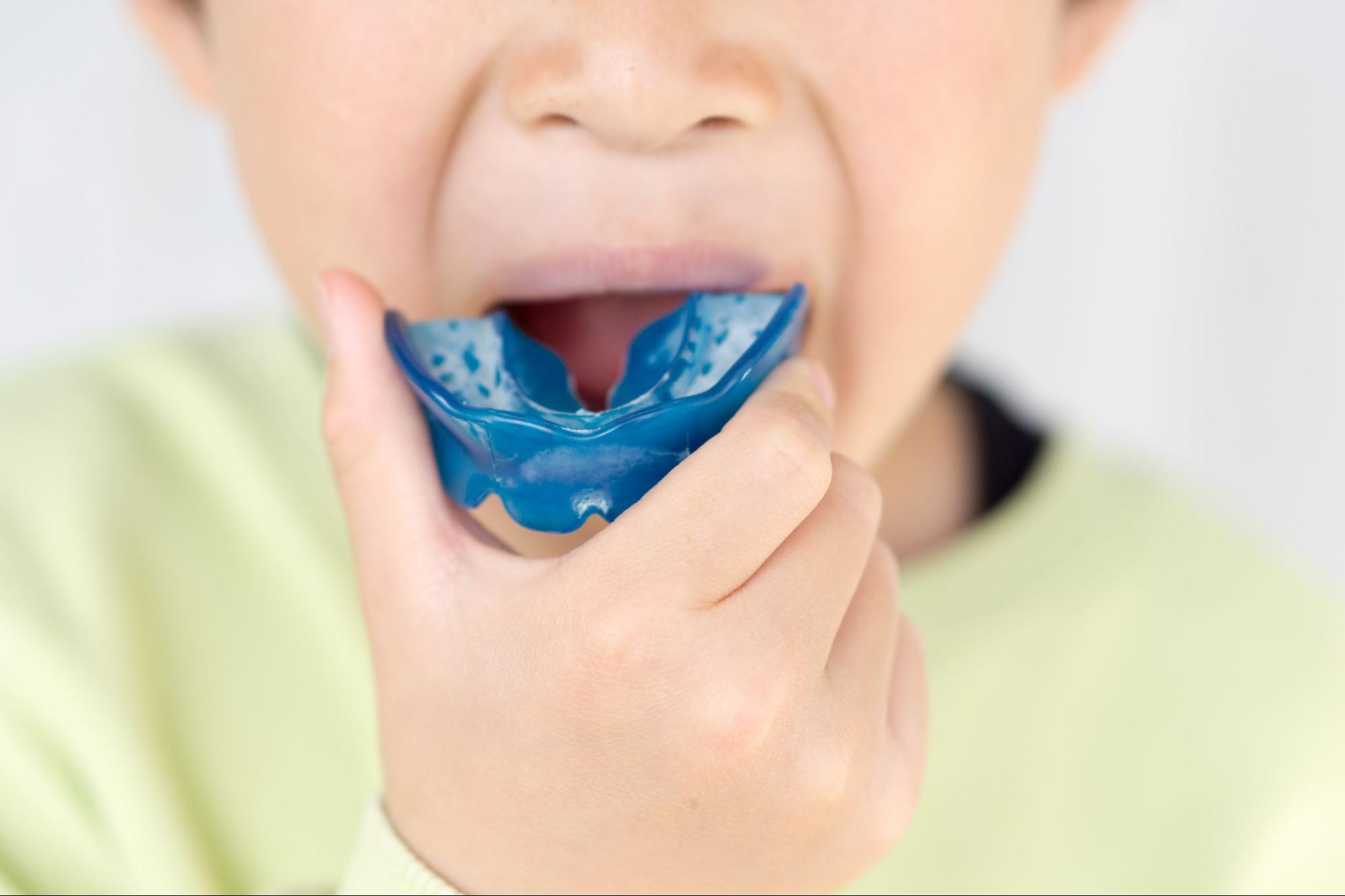 小児のマウスピース矯正について。効果やメリット・デメリット、費用
