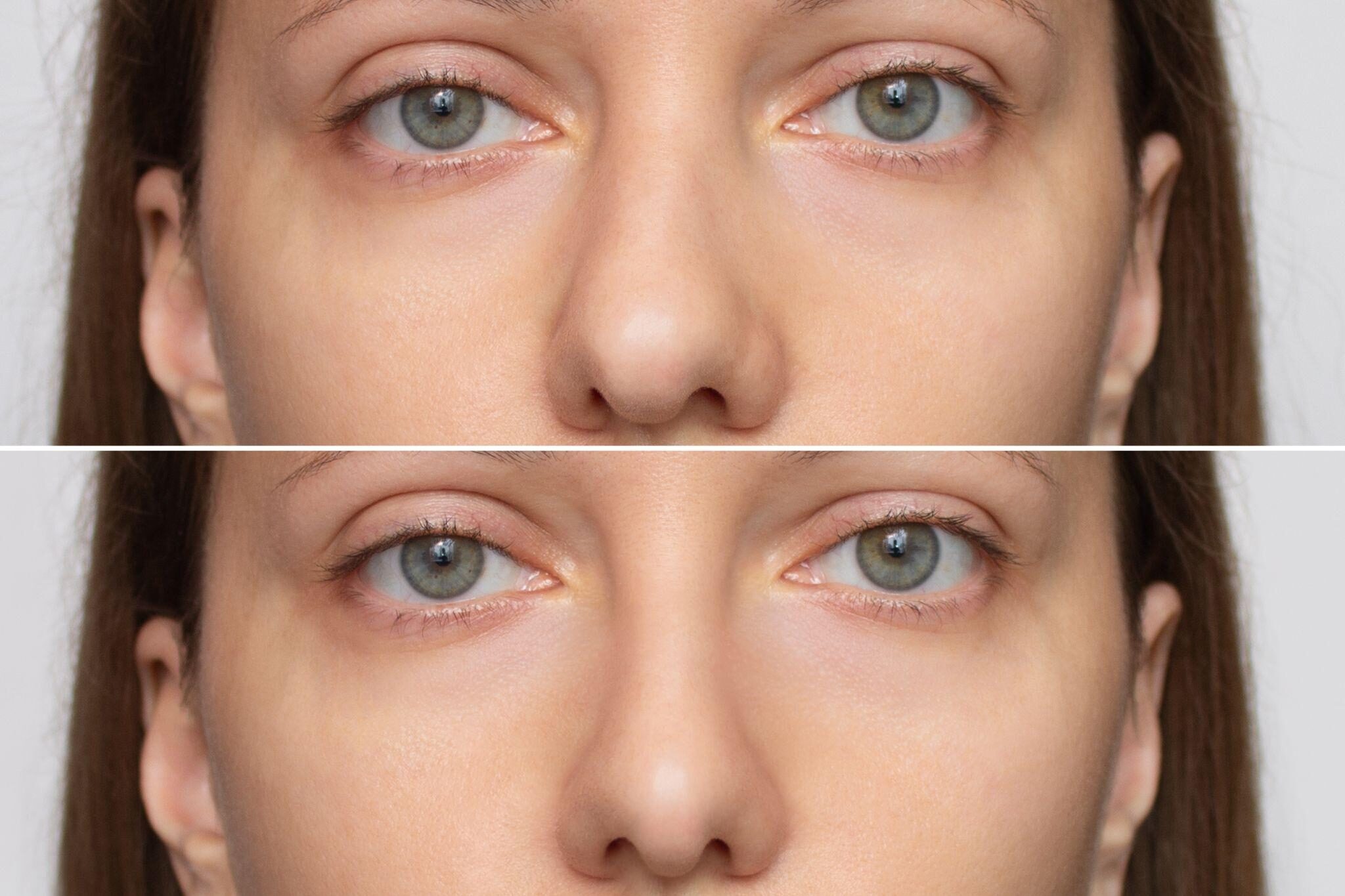 顔の見た目に現れる場合の特徴